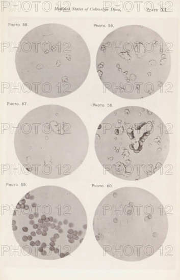 Six enlargements of colorless blood corpuscles, page, photomechanical print, number: 'Pl. XI.',