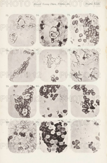 Twelve enlargements of blood corpuscles, page, photomechanical print, number: 'Pl. XIII.', number: