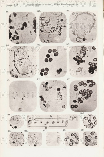 Eleven enlargements of blood corpuscles and fibrin and a diagram, page, photomechanical print,
