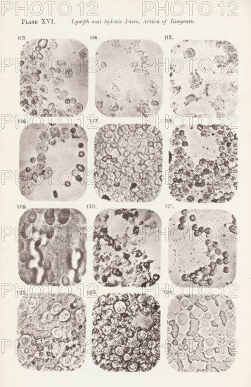 Twelve enlargements of the effects of saline solution on lymphocytes, page, photomechanical print,