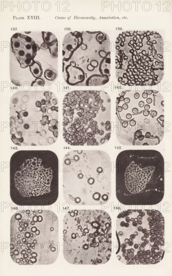 Twelve magnifications of blood corpuscles and myelin, page, photomechanical print, number: 'Pl.