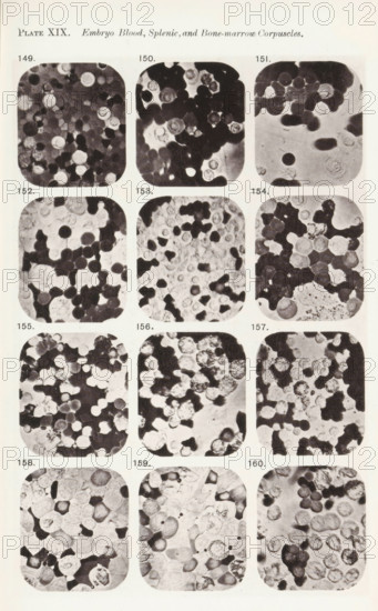 Twelve enlargements of blood cells from an embryo, page, photomechanical print, number: 'Photo. 149