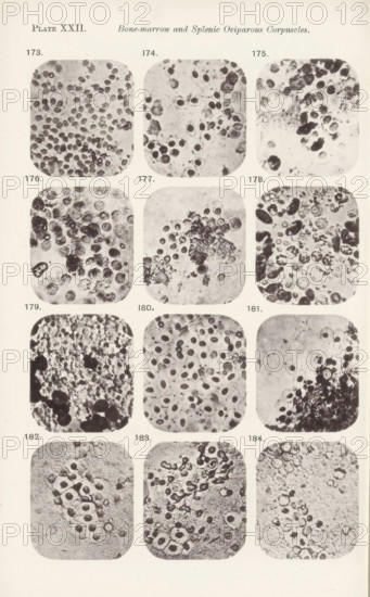 Twelve enlargements of bone marrow, page, photomechanical print, number: 'Pl. XXII.', number: