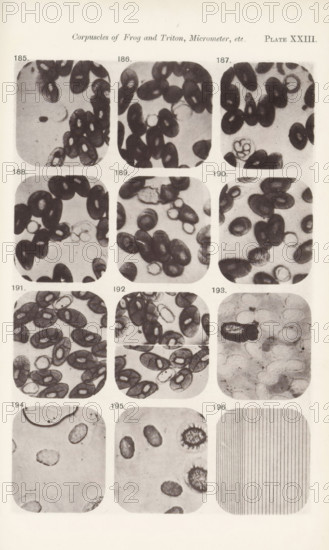 Eleven enlargements of blood cells and a micrometer enlargement, page, photomechanical print,