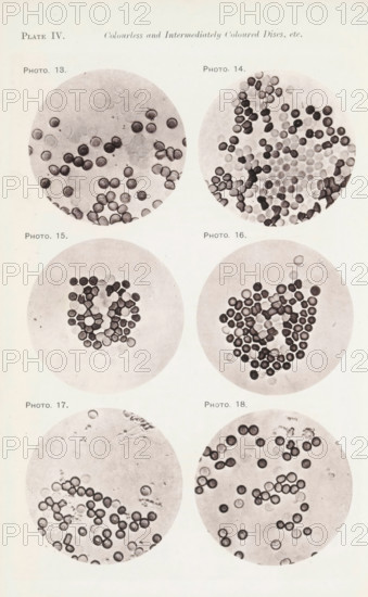 Six enlargements of blood cells, page, photomechanical print, number: 'Photo. 13., Photo. 18.',