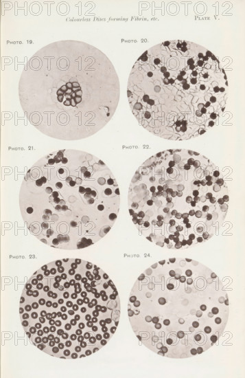 Six enlargements of blood cells, page, photomechanical print, number: 'Pl. V.', number: 'Photo. 19