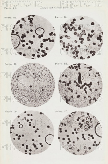 Six enlargements of blood cells and lymphocytes, page, photomechanical print, number: 'Pl. VI.',