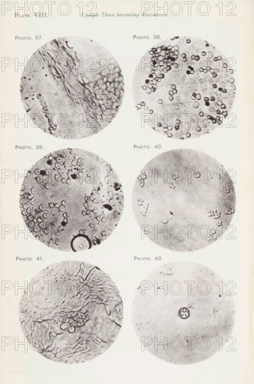 Six enlargements of lymphocytes, page, photomechanical print, number: 'Pl. VIII.', number: 'Photo.