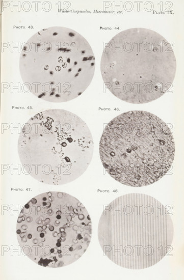 Five enlargements of blood and a micrometer, page, photomechanical print, number: 'Pl. IX.',