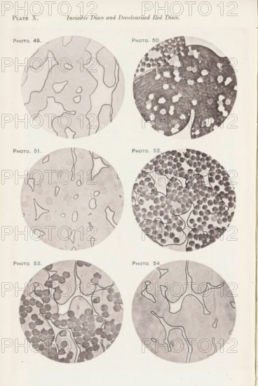 Six enlargements of blood after various procedures, page, photomechanical print, number: 'Pl. X.',