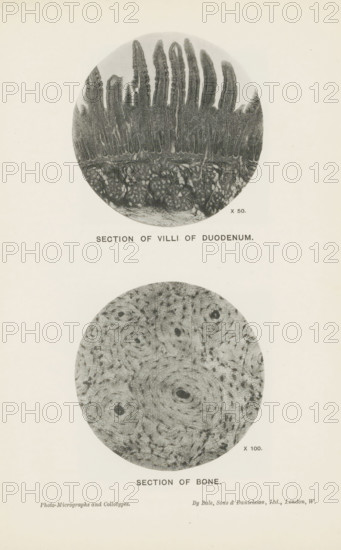 Section of villi of duodenum, Section of bone, page, photomechanical print, inscription: 'x 50. x