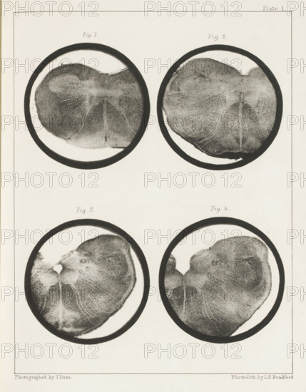Four details of a medulla oblongata of a sheep, page, photomechanical print, number: 'Plate I. Fig.