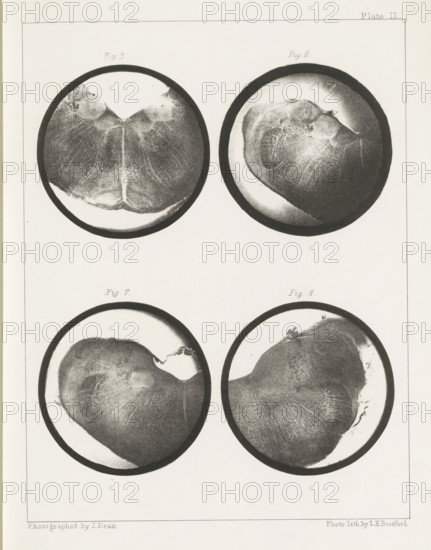 Four cross-sections of a medulla oblongata of a sheep, page, photomechanical print, number: 'Plate