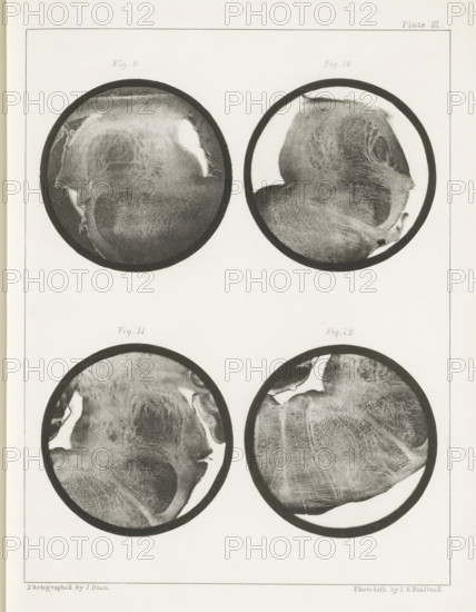 Four details of a sheep medulla oblongata, page, photomechanical print, number: 'Plate III. Fig. 9.