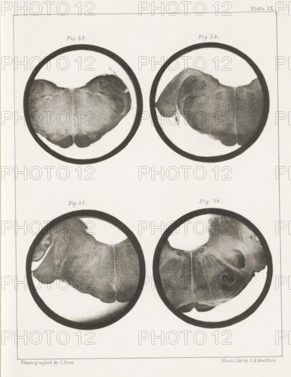 Four details of a human medulla oblongata, page, photomechanical print, number: 'Plate IX. Fig. 33.