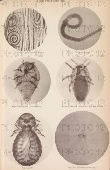 Overview of six microscopic enlargements, page, photomechanical print, Top two hairworms, middle