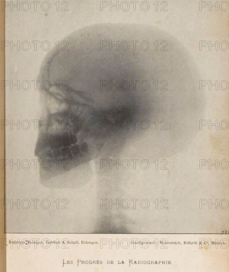 X-ray of a human skull, Les Progrès de la Radiography, page, photomechanical print, photographer:
