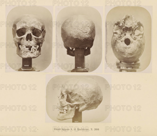 Four images of a Sami female skull, Cranio lappone ?, di Kautokeino, No. 2606, page, Top left a