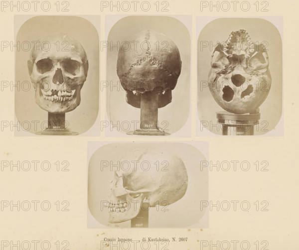 Four images of a Sami skull, Cranio lappone, di Kautokeino, No. 2607, page, Top left a front view,