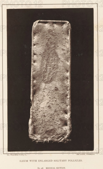 Ileum with Enlarged Solitary Follicles, page, photomechanical print, address: '1002 Arch St.,