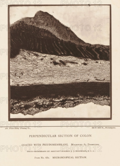 Enlargement of a membrane in a piece of large intestine, Perpendicular Section of Colon Coated with