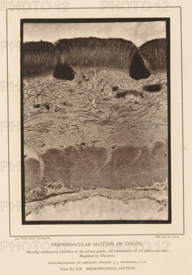 Perpendicular Section of Colon, Enlargement of the formation of ulcers in cavities in a piece of