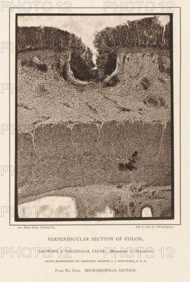 Enlargement of a distended cavity in a piece of large intestine, Perpendicular Section of Colon,