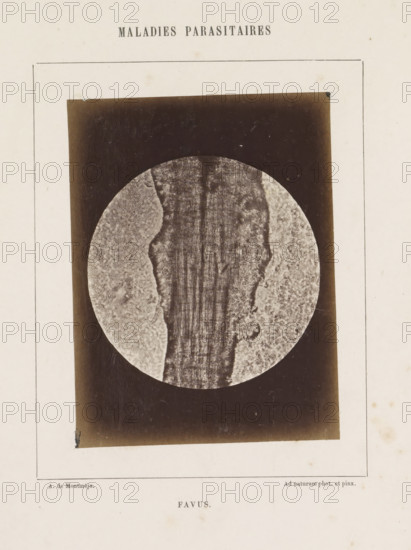 Favus, Microscope image of the disease favus, photograph, page, number: '12', inscription: