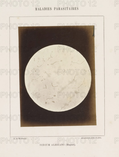Oidium albicans (Muguet), Microscope image of probably candida albicans, photograph, page,
