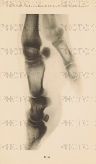 X-ray of a pig's leg, page, photomechanical print, number: 'No 6', photographer: Guequier, Ghent,