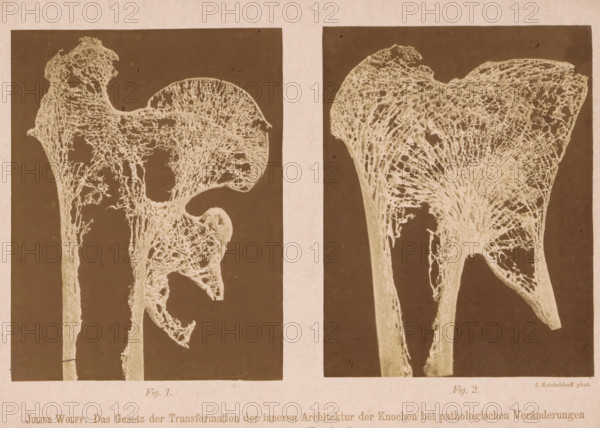 Twice a detail of the structure of the interior of a bone, Julius Wolff: The Gesetz der