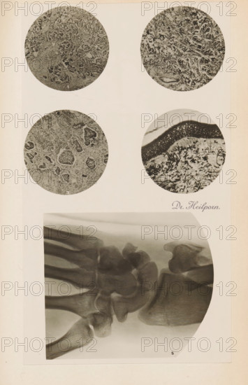 Four enlargements of x-rays, photograph, page, name: 'Drs. Hauchamps et Steinhaus', c. 1904 - in or