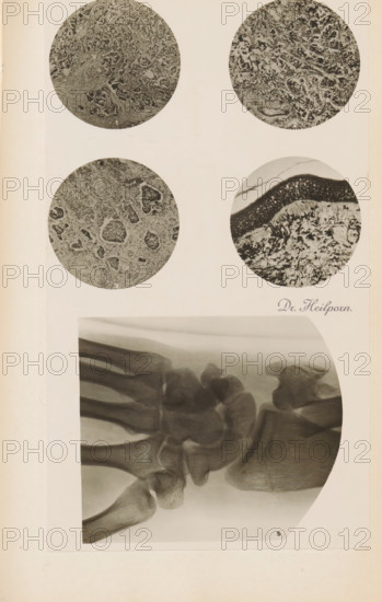 X-ray of a wrist, photograph, page, name: 'Dr. Heilporn', c. 1904 - in or before 1909,