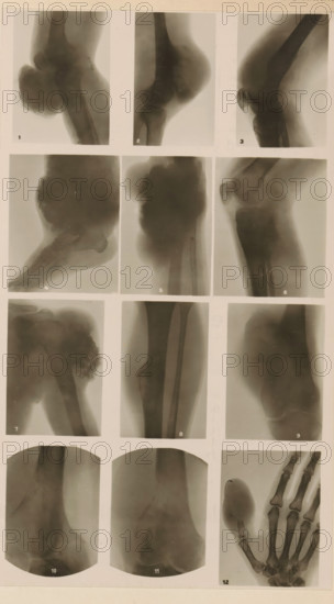Twelve x-rays of different joints, photograph, page, name: 'Dr. Hauchamps.', c. 1904 - in or before