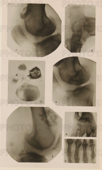 Seven x-rays of various joints and substances, photograph, page, name: 'Dr. Lejeune.', c. 1904 - in
