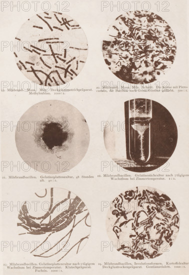 Six microscope images of the anthrax bacterium, page, photomechanical print, number: 'Tafel IV.',