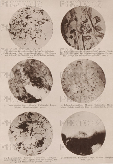 Six microscope images of bacteria, including tuberculosis and leprosy bacilli, page,