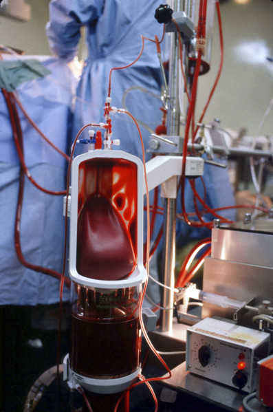 BICHAT-HOPITAL-CARDIOLOGIE