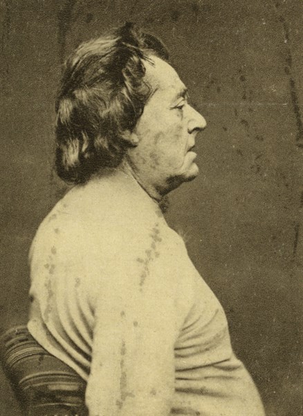 Frédéric Lemaître