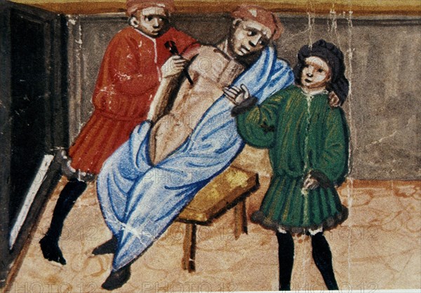 MS 2197 FOL 492-CANON DE AVICENA-OPERACION CON INCISION-ITALIA 1438
BOLONIA, B