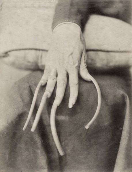 Chine, main aux ongles non coupés