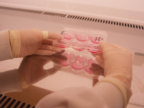Culturing cells