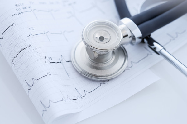 Closeup of stethoscope on monitor printout.