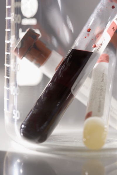 Closeup of blood samples in tubes.