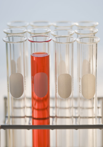 Close up of vials in tray .