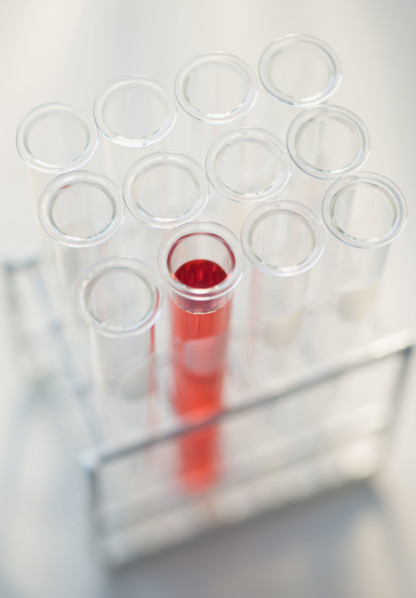 Close up of vials in tray .