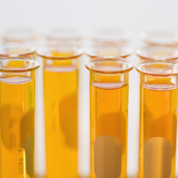 Close up of liquid in vials.