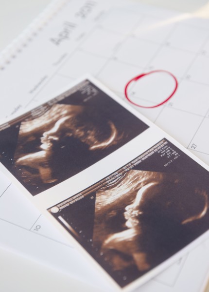 Sonogram picture and calendar with due date. Photo : Jamie Grill Photography