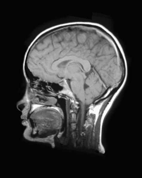 MRI Scan of human head. 
Photo: Calysta Images