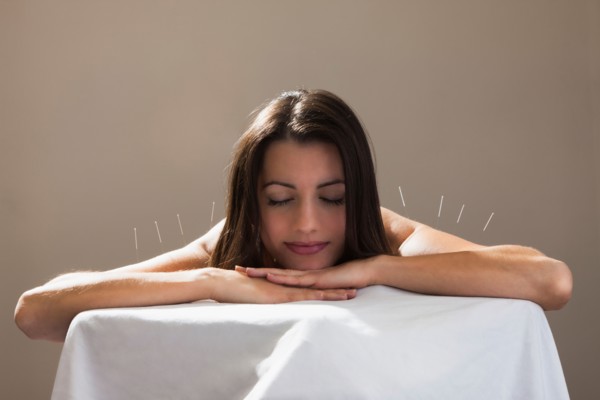 Woman laying on stomach with acupuncture needles in her shoulders. Photo : Mike Kemp